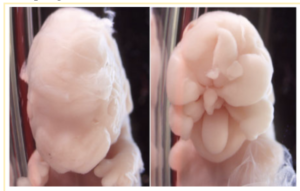 gene editing embryos